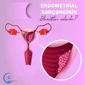 Endometrial xərçəngin əlamətləri
